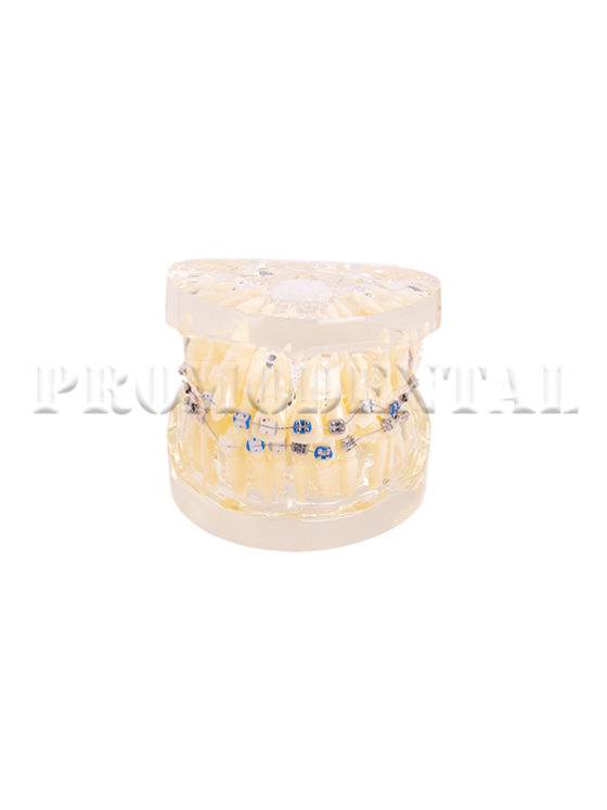 173-A0013-Teeth Model Ortho Metal & Ceramic 173-A0013.png